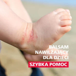 Allergica Dermifant, детский увлажняющий лосьон, быстрая помощь, 200 мл