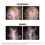 Сироватка-бустер для волосся Vichy Dercos Aminexil Clinical Regen Booster відновлення густоти, проти випадіння волосся, 90 мл: ціни та характеристики