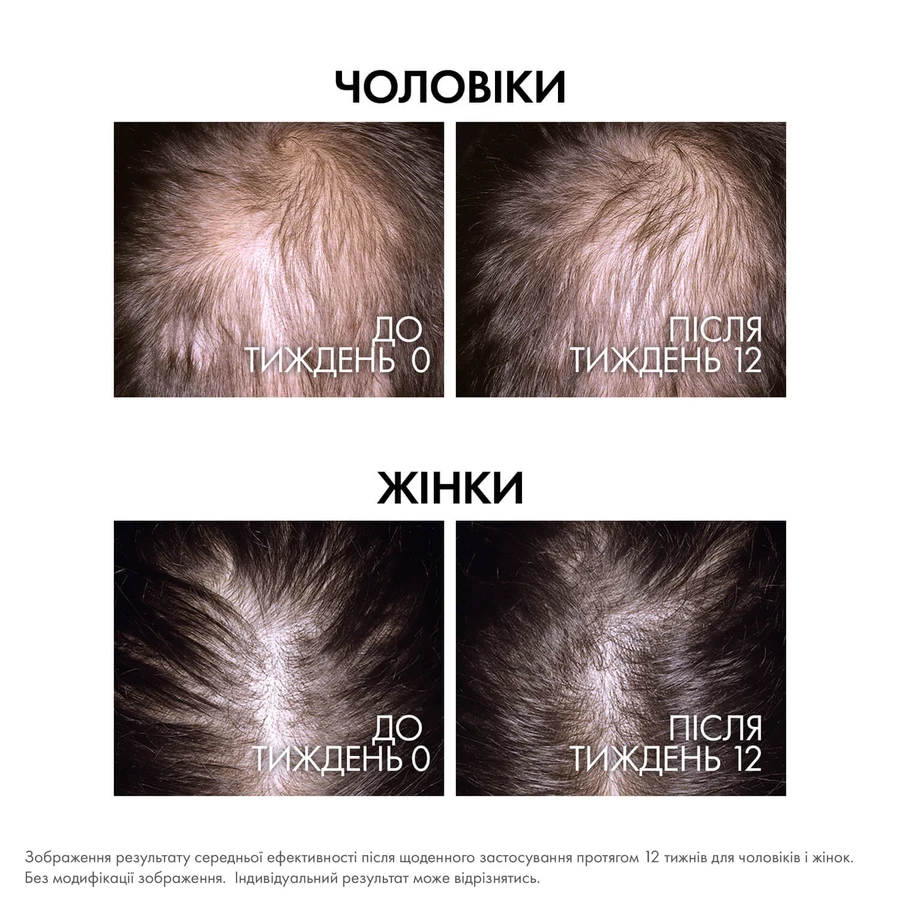 Сироватка-бустер для волосся Vichy Dercos Aminexil Clinical Regen Booster відновлення густоти, проти випадіння волосся, 90 мл: ціни та характеристики