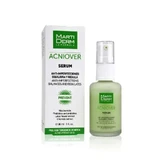 Сироватка Martiderm Acniover 30мл