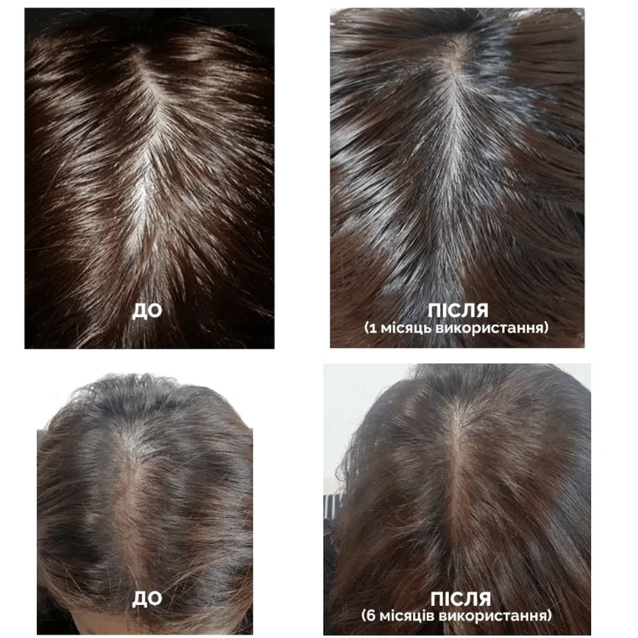 Шампунь для волосся Dr.FORHAIR Folligen Shampoo проти випадіння, 300 мл : ціни та характеристики