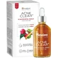 Himalaya Acne Clear+ Сироватка від шрамів від акне 30 мл