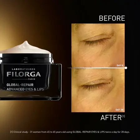 Filorga Global-Repair Advanced Eyes & Lips омолоджуючий крем для контуру очей та губ, 15 мл: ціни та характеристики