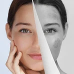 Miraculum Anti-Pigmentation, крем під очі для освітлення темних кіл, 15 мл: ціни та характеристики