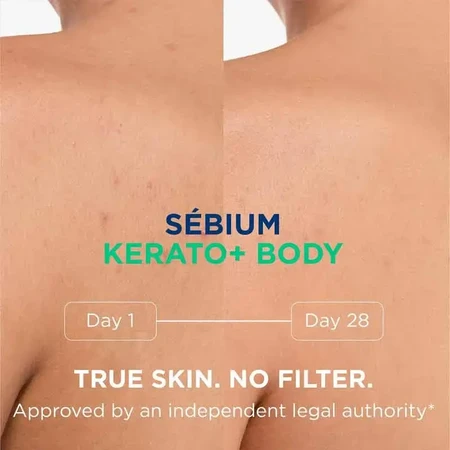 Sebium Kerato+ Спрей для тіла, 2×150 мл, Bioderma: ціни та характеристики