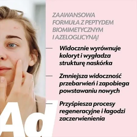Eeny Meeny, сироватка від пігментних плям після акне, 30 мл: ціни та характеристики