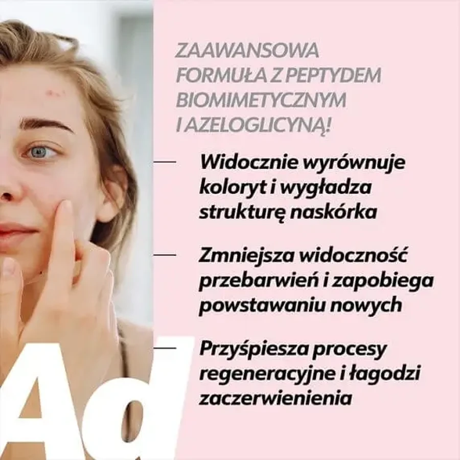 Eeny Meeny, сироватка від пігментних плям після акне, 30 мл: ціни та характеристики