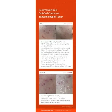 Dr.Melaxin Exosome Repair Toner, тонік для відновлення шкіри з екзосомами, 300 мл: ціни та характеристики