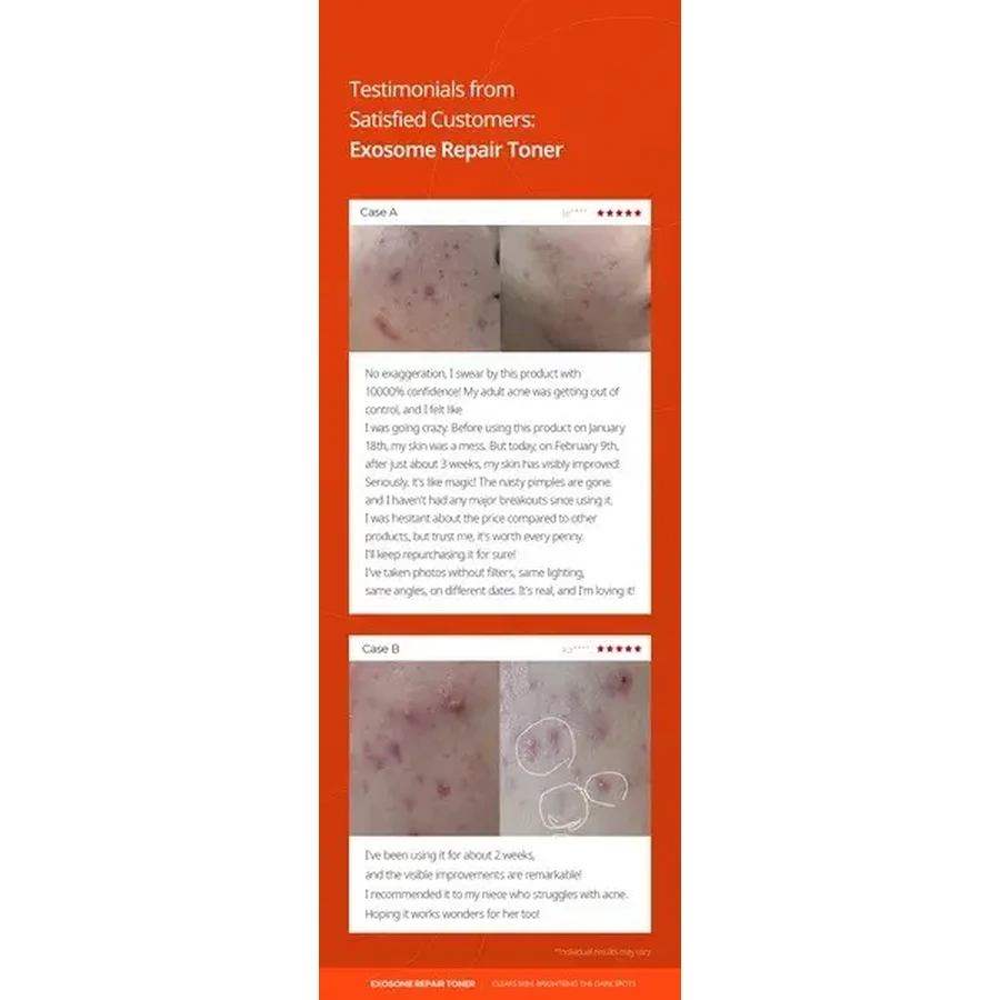Dr.Melaxin Exosome Repair Toner, тонік для відновлення шкіри з екзосомами, 300 мл: ціни та характеристики