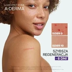 Aderma Epitheliale Ultra Repair, регенерирующий крем против следов, 100 мл: цены и характеристики