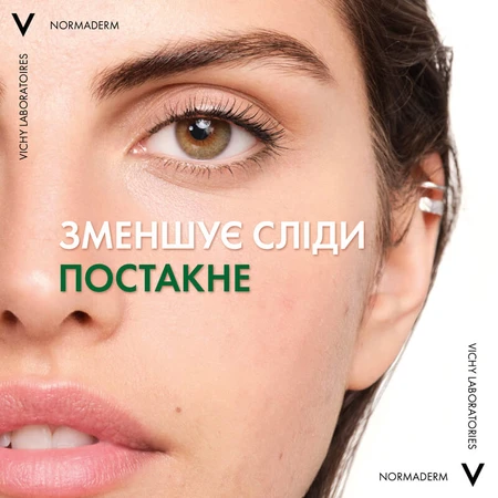 Сыворотка-пилинг Vichy Normaderm Probio-BHA для коррекции недостатков жирной и проблемной кожи лица 30 мл: цены и характеристики