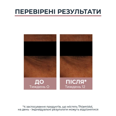 Крем для кожи вокруг глаз Eucerin Anti Pigment для уменьшения темных кругов и пигментации, 15 мл : цены и характеристики
