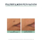 Флюїд для обличчя Eucerin DermoPure захисний для проблемної шкіри SPF30, 50 мл: ціни та характеристики