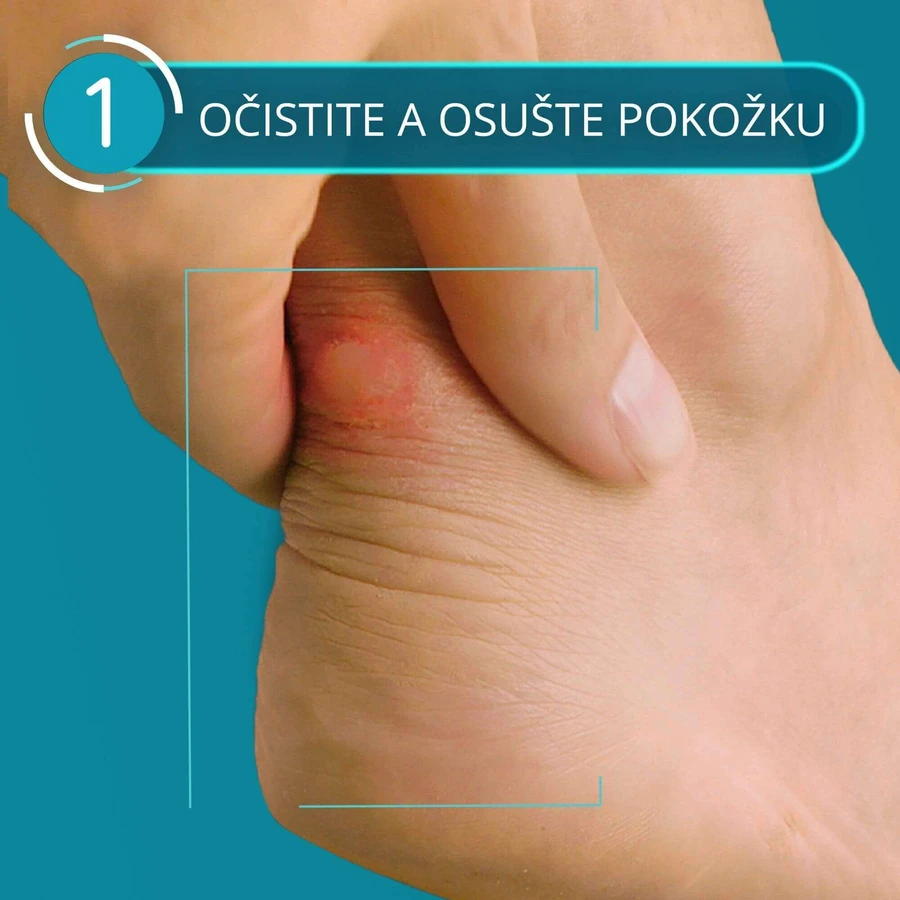 Суміш пластирів Compeed Puzgie 5 шт: ціни та характеристики