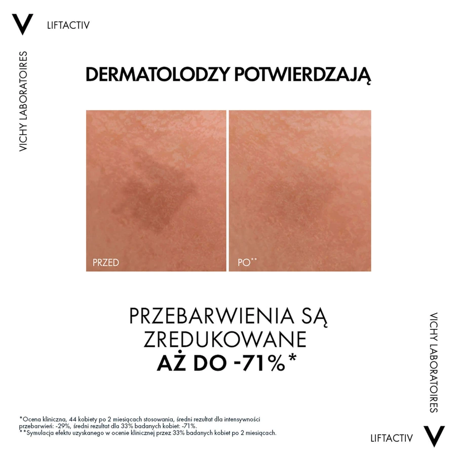 Vichy, Liftactiv Specialist B3 Сироватка для зменшення гіперпігментації та зморшок з 5% ніацинамідом, 30 мл: ціни та характеристики
