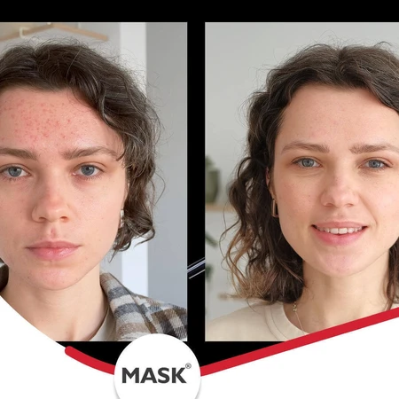 Гель Маска Плюс Solartium Mask Plus Acne Gel , 30 мл: ціни та характеристики