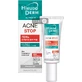 Гель Біокон Hirudo Derm Oil Problem Acne Stop проти вугрів, 19 мл