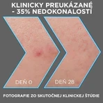 Garnier Pure Активна сироватка проти недосконалостей AHA + BHA Вугілля 30 мл: ціни та характеристики