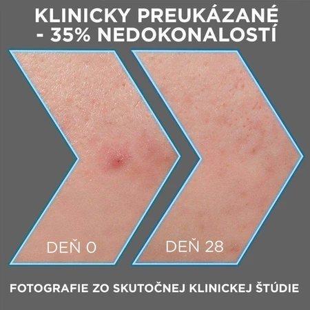 Garnier Pure Активна сироватка проти недосконалостей AHA + BHA Вугілля 30 мл: ціни та характеристики