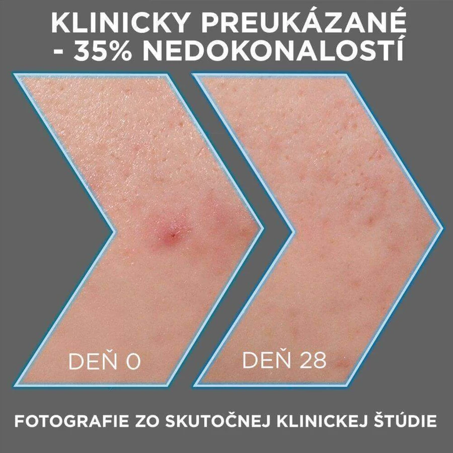 Garnier Pure Активна сироватка проти недосконалостей AHA + BHA Вугілля 30 мл: ціни та характеристики