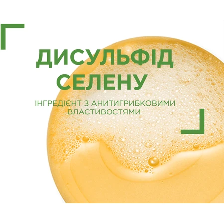 Шампунь Vichy Dercos Дерматологічний проти лупи для нормального, жирного волосся і подразненої шкіри голови, 390 мл: ціни та характеристики