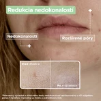 Mixa Sensitive Skin Expert Anti-Imperfection Serum 30 мл: цены и характеристики
