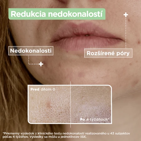 Mixa Sensitive Skin Expert Anti-Imperfection Serum 30 мл: цены и характеристики