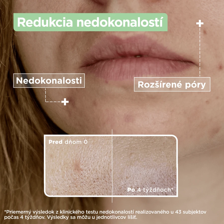 Mixa Sensitive Skin Expert Anti-Imperfection Serum 30 мл: цены и характеристики