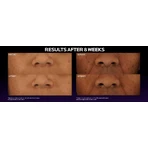 La Roche-Posay MELA B3 Сыворотка от темных пятен с меласилом + ниацинамидом 30 мл: цены и характеристики