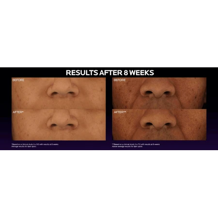 La Roche-Posay MELA B3 Сыворотка от темных пятен с меласилом + ниацинамидом 30 мл: цены и характеристики