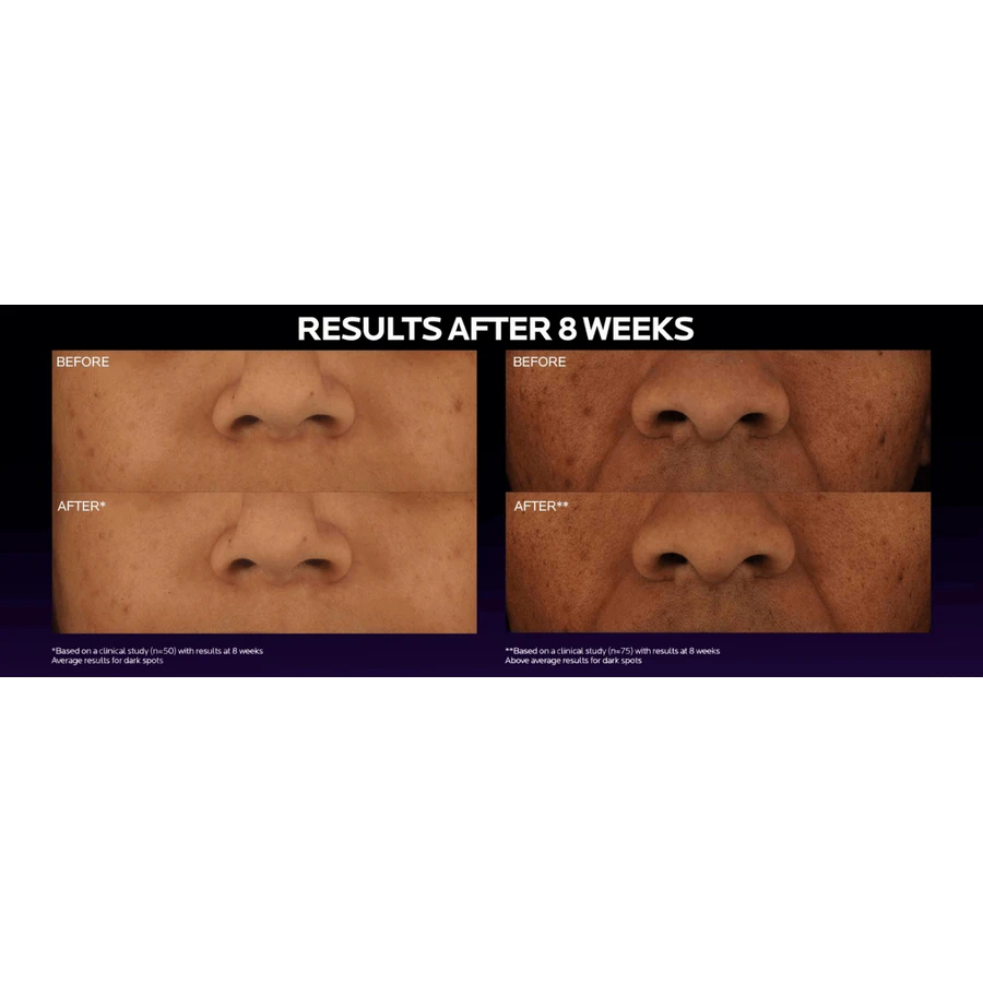 La Roche-Posay MELA B3 Сыворотка от темных пятен с меласилом + ниацинамидом 30 мл: цены и характеристики