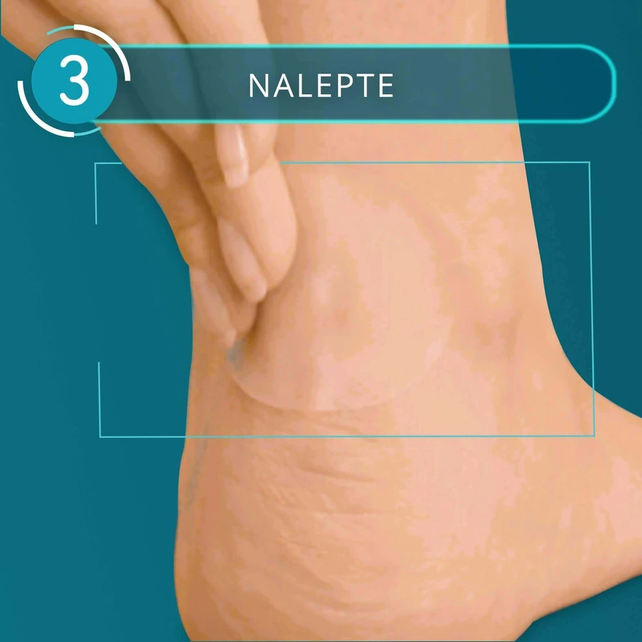 Compeed Пластыри для мозолей средние 5 шт: цены и характеристики