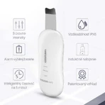 Ультразвуковий шпатель для обличчя TouchBeauty 1887: ціни та характеристики