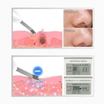 Ультразвуковий шпатель для обличчя TouchBeauty 1887: ціни та характеристики