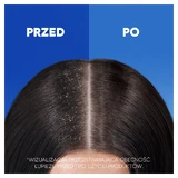 Head & Shoulders Apple Fresh, шампунь против перхоти, 400 мл