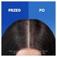 Head & Shoulders Apple Fresh, шампунь против перхоти, 400 мл