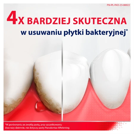 Parodontax Fluoride зубна паста з фтором, 75мл: ціни та характеристики