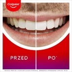 Colgate Max White Overnight, аппликатор для отбеливания, 2,5 мл: цены и характеристики