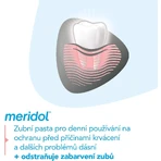 Meridol® Защита десен и нежное отбеливание Зубная паста для защиты десен и нежного отбеливания 3 x 75 мл: цены и характеристики