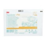 Пленочная прозрачная повязка с впитывающей подушечкой Tegaderm+Pad 3586, 9 x 10 см: цены и характеристики