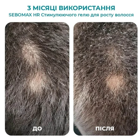 Гель для волос Biotrade Sebomax, стимулирующий, против выпадения, 26 мл: цены и характеристики