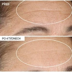 Омолоджуючий крем StriVectin Advanced Retinol Nony 30 мл: ціни та характеристики