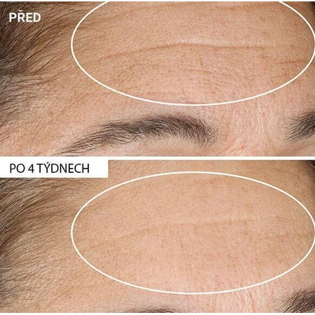 Омолоджуючий крем StriVectin Advanced Retinol Nony 30 мл: ціни та характеристики