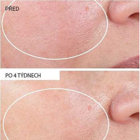 Омолоджуючий крем StriVectin Advanced Retinol Nony 30 мл: ціни та характеристики