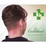 Cannaderm Capillus seborrhoea ампула 150 мл: ціни та характеристики