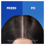 Head & Shoulders Citrus Fresh, шампунь проти лупи, 400 мл: ціни та характеристики
