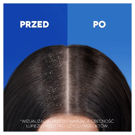 Head & Shoulders Citrus Fresh, шампунь проти лупи, 400 мл: ціни та характеристики