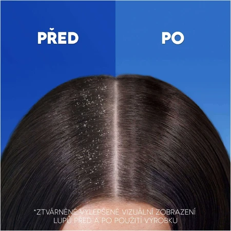 Head & Shoulders Ампон глубокого увлажнения 400 мл: цены и характеристики