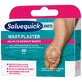 Пластир від бородавок Salvequick Wart, 20 шт.