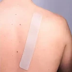 Пластырь от шрамов Resolve Skin SPF50+, 25 x 4 см, 1 штука, Pietrasanta Pharma: цены и характеристики